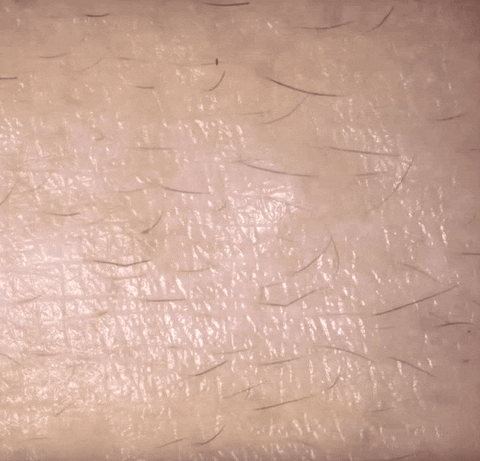 weird skin by round